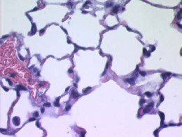 Normal mouse lung Normal mouse lung