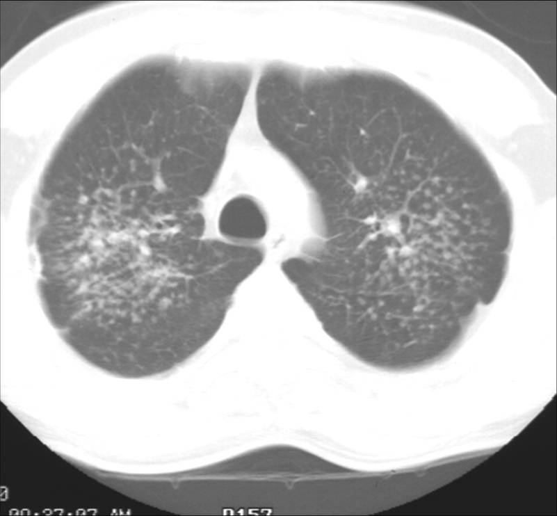 Figure 1b