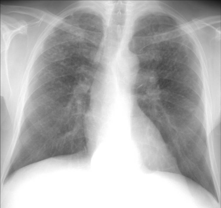 Figure 1a