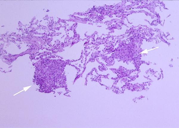 Figure 2a