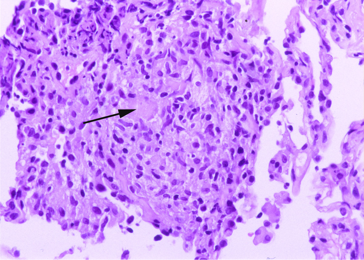 Figure 2b