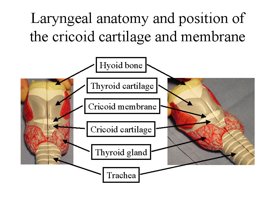 American Thoracic Society Endotracheal Intubation by Direct Laryngoscopy