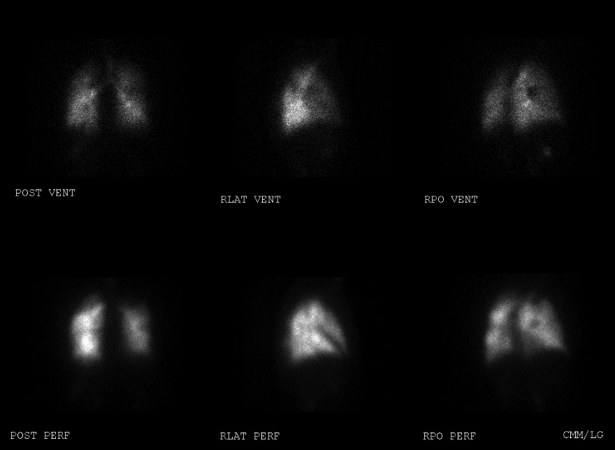 figure2