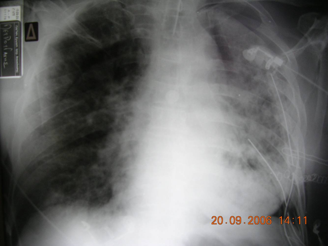 Figure 1 Figure 1