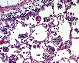 Intranasal LPS