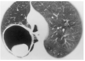 an-unexpected-etiology-of-ventricular-dysrhythmia