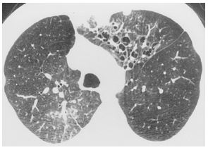 an-unexpected-etiology-of-ventricular-dysrhythmia