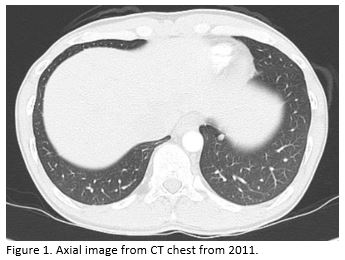 A Coin in the Lung 1