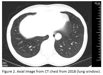 A Coin in the Lung 2