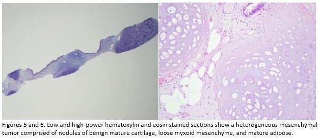 A Coin in the Lung 5