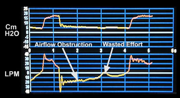 Waveform 2