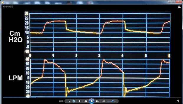 Waveform 3