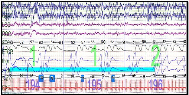 Hypoxemia in a Premature Child