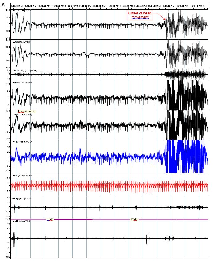 Figure 1a