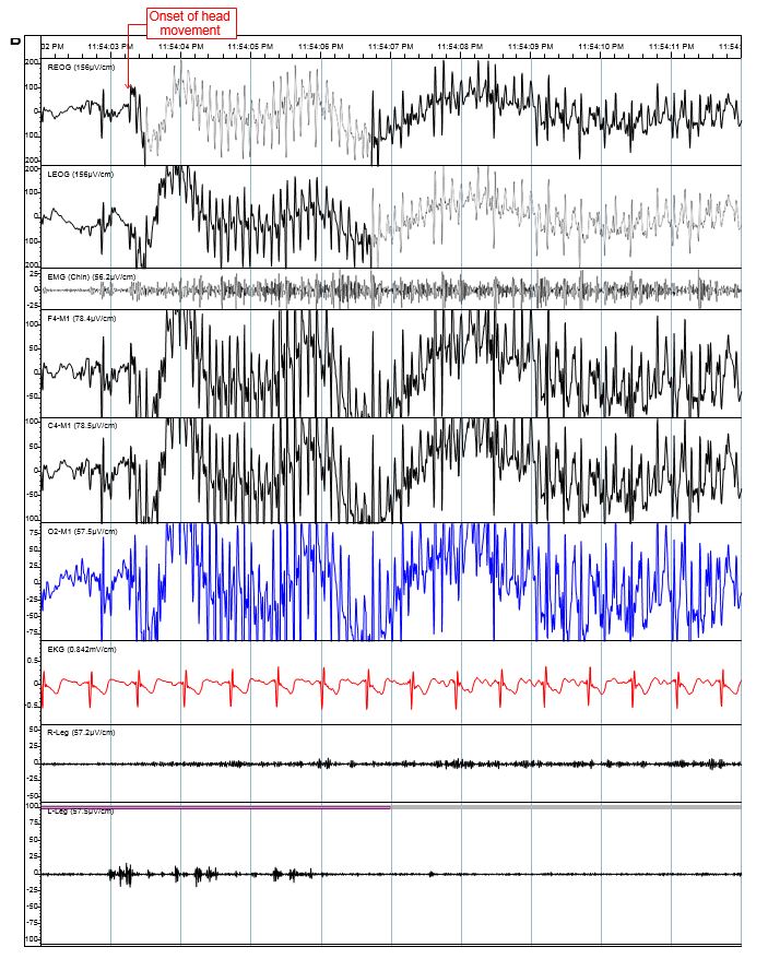 Figure 1b