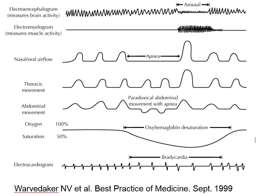 figure2