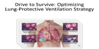 Drive to Survive: Optimizing lung protective ventilation strategy
