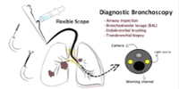 Introduction to Interventional Pulmonary for Students and Residents