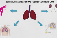 Lymphangioleiomyomatosis