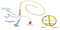 Proper Insertion and Use of a Pulmonary Artery Catheter