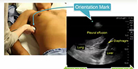 Ultrasound Basics