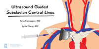 Ultrasound Guided Subclavian Central Lines