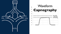 Waveform Capnography